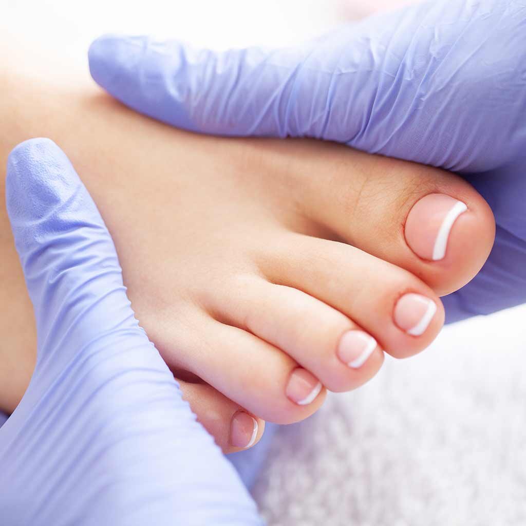 Hammer Toes  Diagnosis, Causes & Treatments